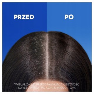 HEAD&SHOULDERS VOLUME SZAMPON DO WŁOSÓW PRZECIWŁUPIEŻOWY NA OBJĘTOŚĆ 400ml