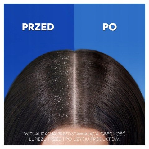 HEAD&SHOULDERS VOLUME SZAMPON DO WŁOSÓW PRZECIWŁUPIEŻOWY NA OBJĘTOŚĆ 400ml