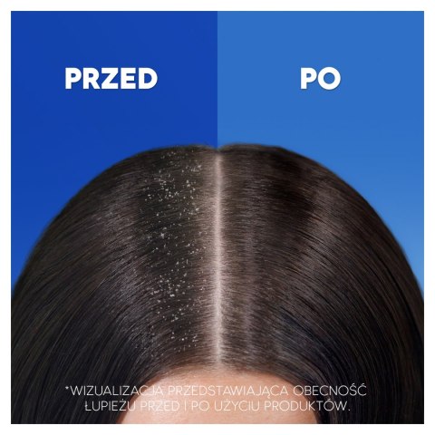 HEAD&SHOULDERS VOLUME SZAMPON DO WŁOSÓW PRZECIWŁUPIEŻOWY NA OBJĘTOŚĆ 400ml